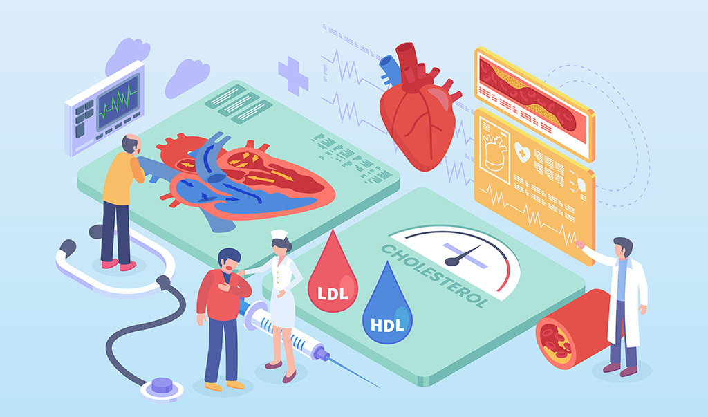 Illustrazione per diete-ipertrigliceridemie-ipercolesterolemie